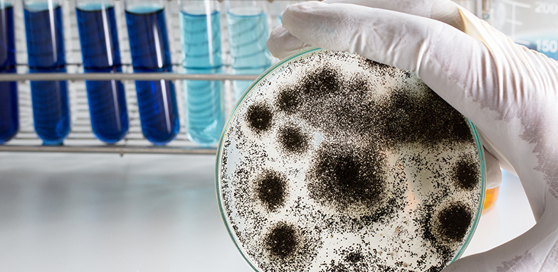 Mold culture plate held in a gloved hand at an accredited laboratory used for San Diego mold testing